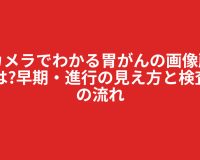 胃カメラでわかる胃がんの画像所見とは?早期・進行の見え方と検査後の流れ